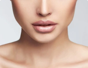 Imagem ilustrativa do preenchimento labial com ácido hialurônico, destacando volume, contorno e naturalidade. Procedimento oferecido pela Dra. Beatriz Bandeira em Fortaleza-CE.