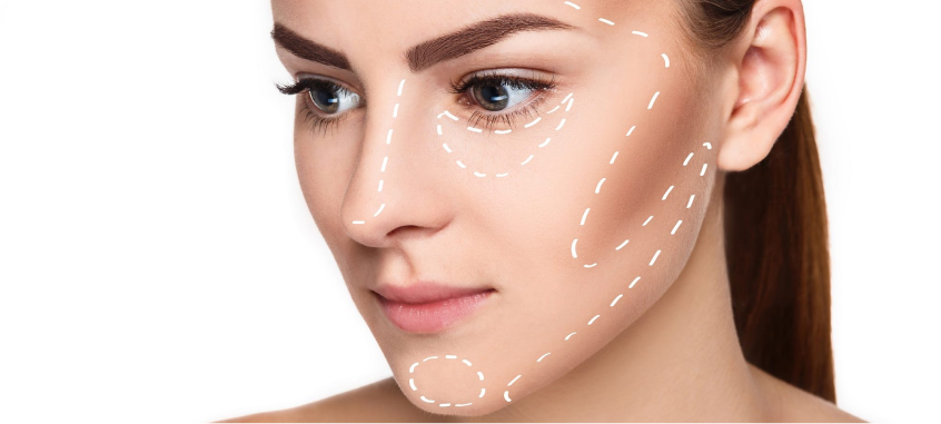 Uso de ácido hialurônico na harmonização facial