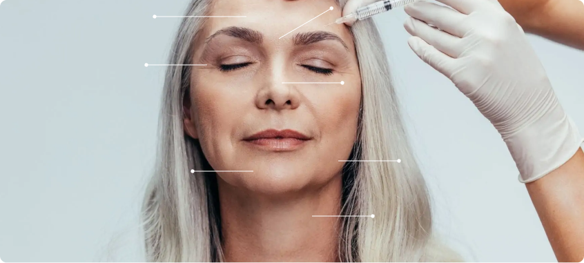 Aplicação de botox em Fortaleza